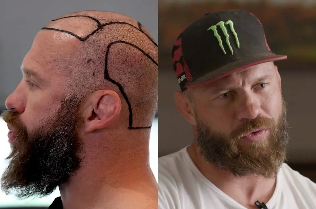 Cerrone has partnered with Relentless Skincare to boost their beard oil products