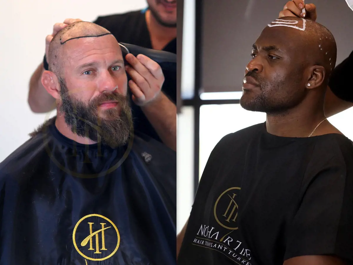 Cerrone took suggestion from his pal Francis about Now Hair Time